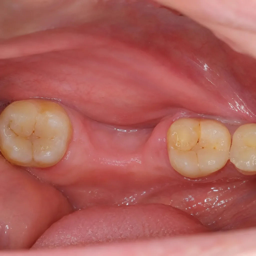 Before image