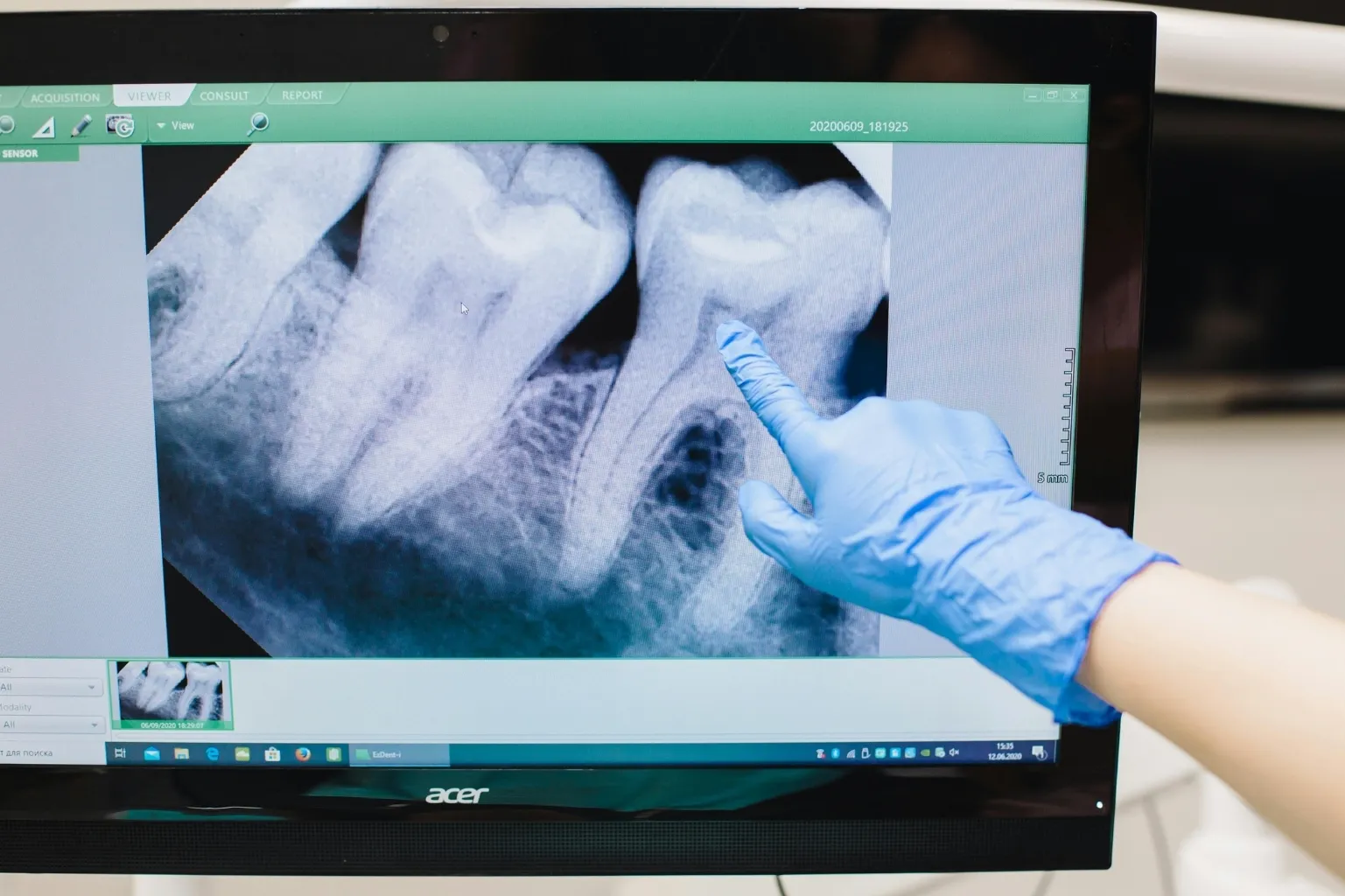 3D Dental Scan