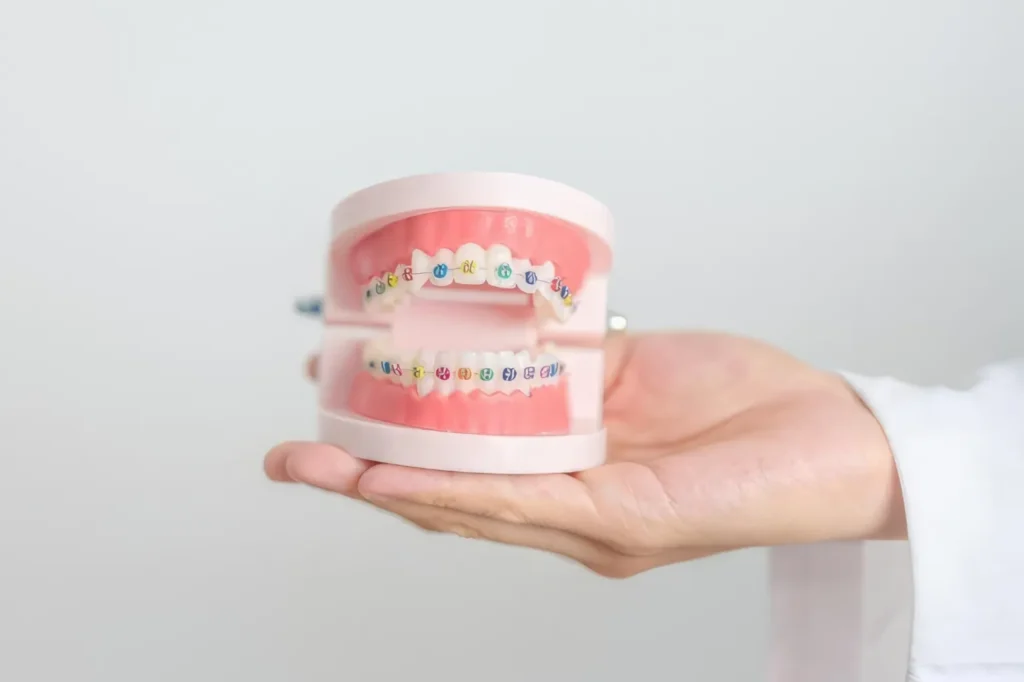 Orthodontic teeth model